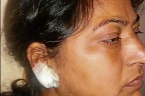 Man tears off woman’s earlobe to steal her earring